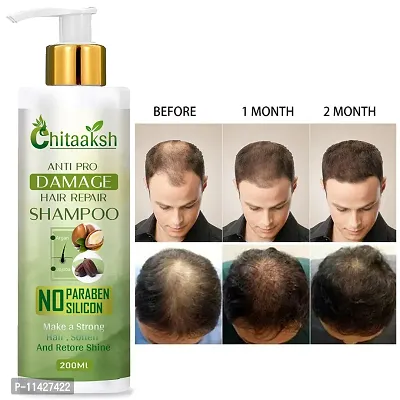 Herbal A Ml A And Bhringraj Herbal Shampoo - Hair Growth And Root Strengthening 200 Ml-thumb0