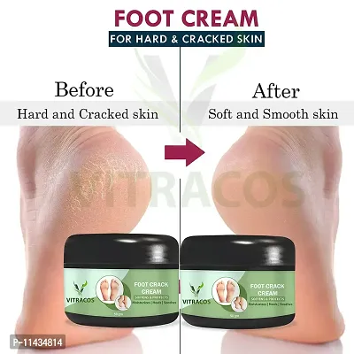 Foot Cream  Soothes  Softens  Protects Feet- Pack Of 2, 50 Grams each