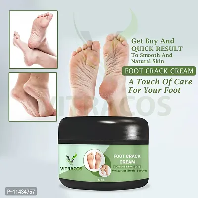 Foot Cream  New Arivals Foot Cream Flavour- 50 Grams