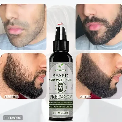 Vitracos Beard Growth Oil For Men For Better Beard Growth With Thicker Beard-thumb0