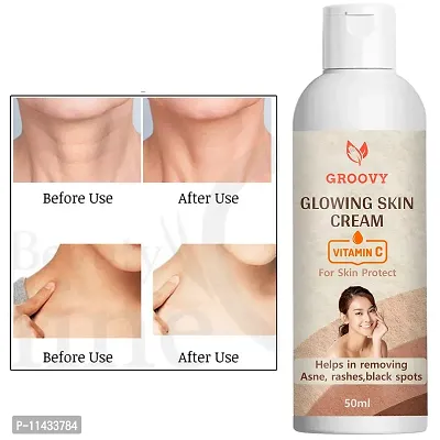 Groovy Whitening Body Lotion On Spf15+ Skin Lighten And Brightening Body Lotion Cream-Brightening For Women And Men- 50 Ml-thumb0