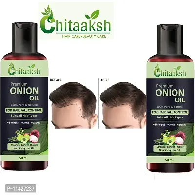 Onion Hair Oil - With Comb Applicator- Black Seed Onion Oil For Damage Control, Hair Regrowth And Hair Fall Control -Men And Women Hair Oil Pack Of 2-thumb0