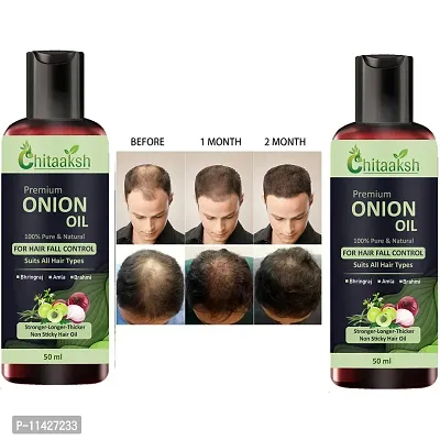 Ayurvedic Onion With Black Seed Oil For Controls Hair Fall Hair Oil 50 Ml Pack Of 2-thumb0