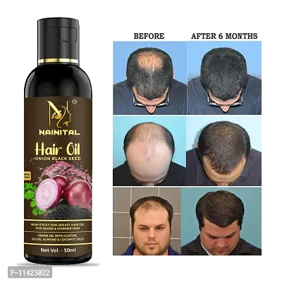 Onion With Black Seed Oil For Controls For Men And Women Hair Fall Hair Oil 50 Ml-thumb0