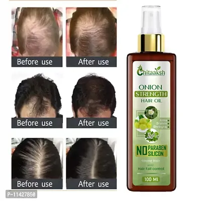 Chitaaksh Onion And Bhringraj Hair Oil With 4X Growth Action - Stimulates The Roots And Prevents Baldness 100 Ml Hair Oil- 100 Ml-thumb0