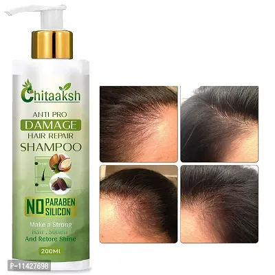 Ayurveda A Ml A Reetha Shikakai Shampoo For Hair Growth Ayurvedic Anti Hairfall And Anti Dandruff Shampoo 200 Ml-thumb0