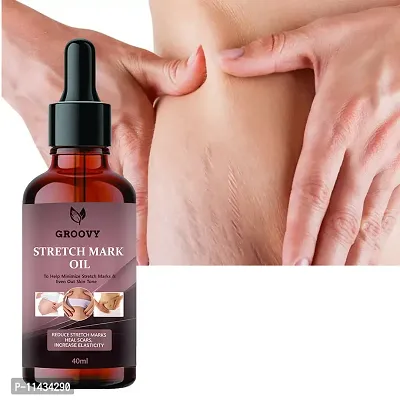 Stretch Marks Oil  Stretch Marks Oil To Reduce Stretch Marks Of Body, Belly, Thighs, Uneven Skin Tone, Firming, Nourishment For Woman  40  ml-thumb0