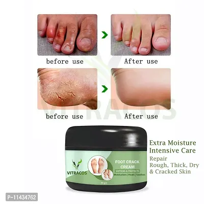 Foot Care Cream For Rough, Dry And Cracked Heel  For Man - 50 Grams-thumb0