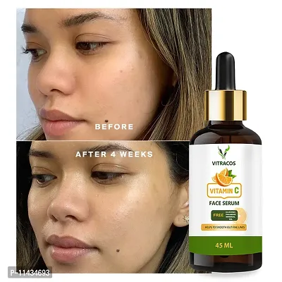 Vitracos Skin Correct Face Serum With Niacinamide And Ginger Extract For Acne Marks And Scars - 45  ml  45  ml-thumb0