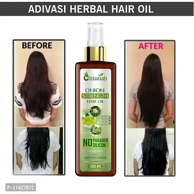 Chitaaksh Onion Oil For Hair Regrowth And Hair Fall Control Hair Oil 100 Ml-thumb0