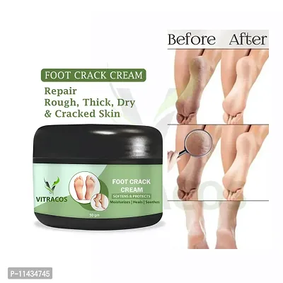 Foot Crack Cream- 50 Grams