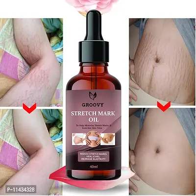 Stretch Marks Oil  Stretch Mark Removal Oil Women And Men, Marks And Spots Removal- 40 ml-thumb0