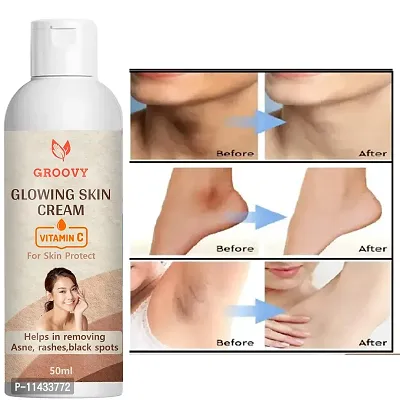 Body Lotion Spf15+ Skin Lighten And Brightening Cream Whitening Cream Shields Your Skin From Hurtful Uv Beams Additionally For Glowing Skin With The Goodness Of 50Ml Pack Of 1-thumb0