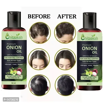 RED ONION METHI HAIR OIL FOR MEN  WOMEN FOR HELP TO REDUCE HAIR DANDRUFF  HAIR GROWTH 50ml Pack Of  PACK OF 2-thumb0