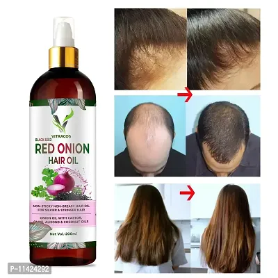 Onion Oil - Black Seed Onion Hair Oil Hair Oil -200 Ml-thumb0