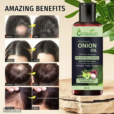 Hair Oil Herbal Hair Oil Blend Of Natural Oils For Increase Hair Growth, Dandruff Control And To Stop Hair Fall-thumb0