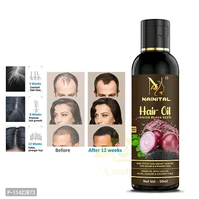 Hair Oil With Dandruff Control , Black Seed - Hair Care , For Hair Growth For Men And Women 50 Ml