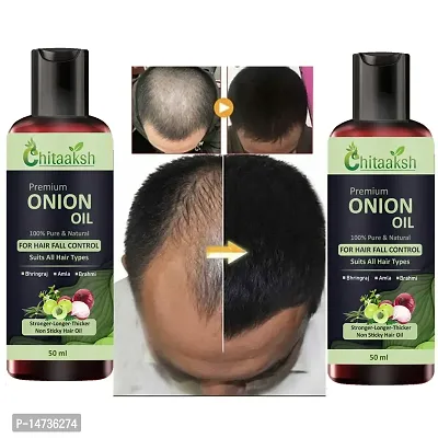 Onion Argan Oil (Pack Of 1) Hair Oils PACK OF 2-thumb0