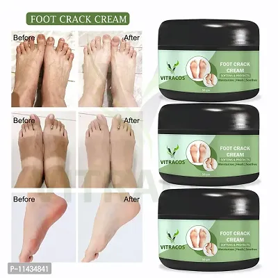 Foot Care Cream For Rough, Dry And Cracked Heel  Feet Cream For Heel Repair Healing And Softening Cream- Pack Of 3, 50 Grams each-thumb0