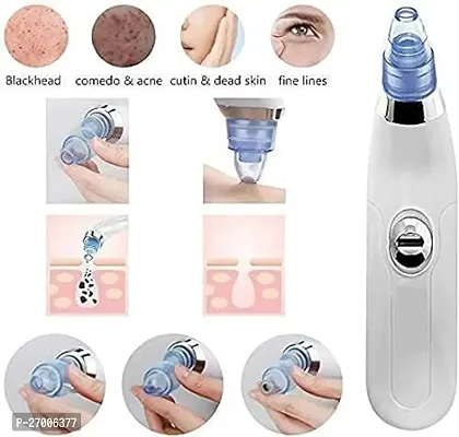 Dermasuction 4 In 1 Multi-Function Blackhead Whitehead Extractor Remover Device - Acne Pimple Pore Cleaner Suction-thumb0