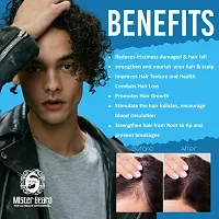 Mister Beard Hair Fall Control Oil Controls Hair Fall. Nourishes Scalp Boosts Hair Growth, Contains Ginger, Rosemary, Thuja Extracts, Non-Sticky Formula, Suitable For Men And Women,100Ml-thumb1