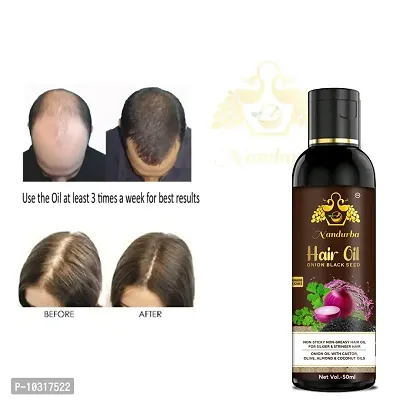 Red Onion Hair Oil - With Deep Root Hair Applicator - Controls Hair Fall And Promotes Growth - Hair Oil 50Ml-thumb0