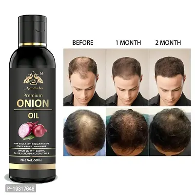 Onion Black Seed Hair Oil 50Ml-thumb0