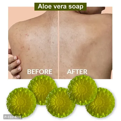 Aloe Vera Clean Bathing Soap -100 Grams Each, Pack Of 5-thumb0