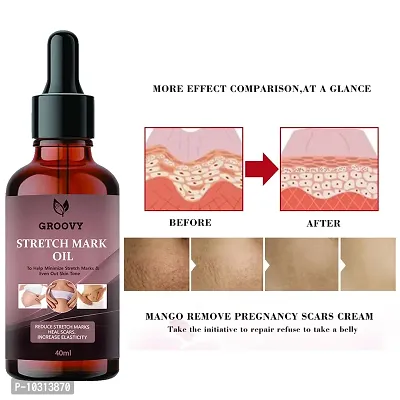 Stretch Marks Oil Stretch Mark And Scar Mark Removal Oil For Men And Women - 40 Ml-thumb0