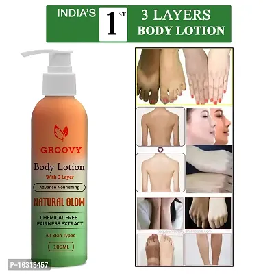 Skin Whitening Face Lotion For Oily Skin, Anti Pimple Lotion,- 100 Ml-thumb0