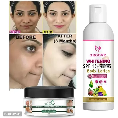 &nbsp;Smooth Charming Lotion With Aloe Vera And Olive Butter 100 ml With Whitening Cream Pack Of 2-thumb0