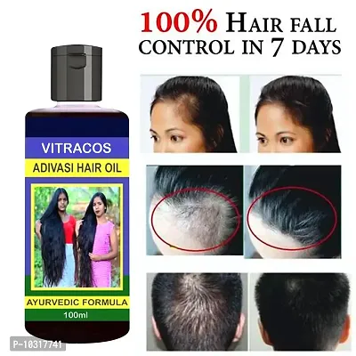 Kasturi Herbal Hair Oil 100 Ml For Women And Men For Hair Long - Dandruff Control - Hair Loss Control - Long Hair - Hair Regrowth Hair Oil- 100 Ml-thumb0