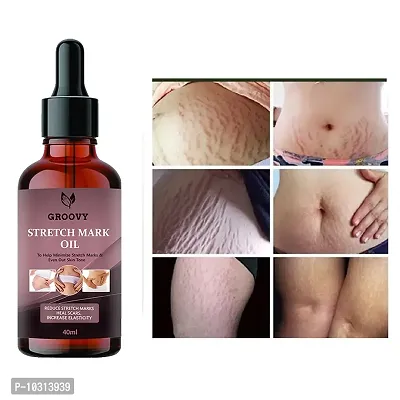 Stretch Marks Oil Stretch Marks Oil To Reduce Stretch Marks Of Body, Belly, Thighs, Uneven Skin Tone, Firming, Nourishment For Women 40 Ml-thumb0