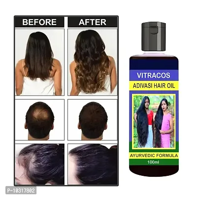 Advanced Hair Oil-Hair Growth Oil- 100 Ml
