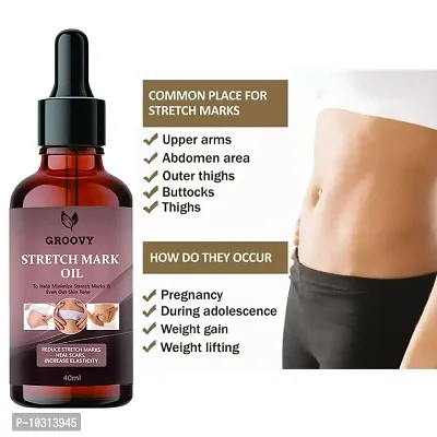 Stretch Marks Oilpresent Repair Stretch Marks Removal - Natural Heal Pregnancy Breast, Hip, Legs, Mark Oil 40 Ml-thumb2