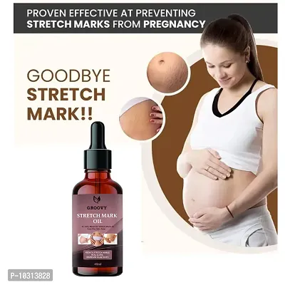 Stretch Marks Oil Stretch Mark Cream To Reduce Stretch Marks And Scars-40 Ml-thumb4
