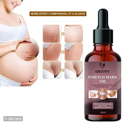 Stretch Marks Oil Organics Stretch Mark Oil - Scars, Stretch Mark, Ageing, Uneven Skin Tone 40 Ml-thumb0