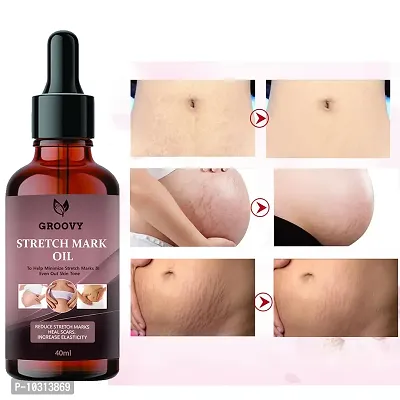 Stretch Marks Oil Advance Natural Stretch Oil For Scars And Stretchmarks 40 Ml-thumb0