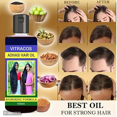 Neelambari Herbal Hair Oil For Hair Growth Hair Fall And Dandruff Controll - 100 Ml-thumb0