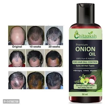 Hair Oil 7 Day Challenge for Hair growth (Pack of 1) for man and woman.-thumb0