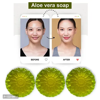 Aloe Vera Hydrating Soap Bar-100 Grams Each, Pack Of 3-thumb0