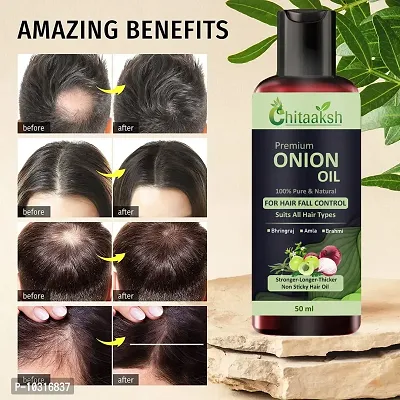 Hair Oil Herbal Hair Oil Blend Of Natural Oils For Increase Hair Growth, Dandruff Control And To Stop Hair Fall-thumb0