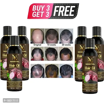 Onion Hair Oil 7 Day Challenge For Hair Growth Buy 3 Get 3 Free-thumb0