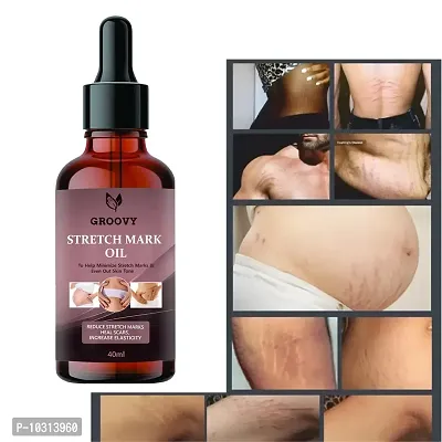 Stretch Marks Oil After Delivery Effective And No Chemical 40Ml-thumb0