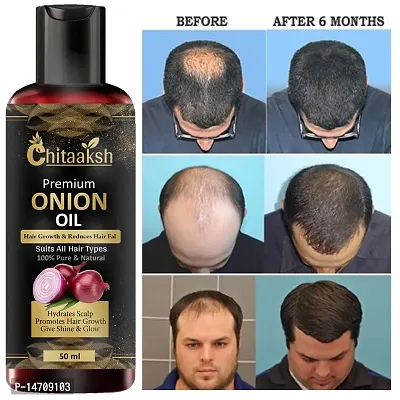 ONION OIL ANTI HAIR LOSS  HAIR GROWTH OIL WITH PURE ARGAN, BLACK SEED OIL IN PUREST FORM VERY EFFECTIVELY CONTROL HAIR LOSS, PROMOTES HAIR GROWTH 50ml-thumb0