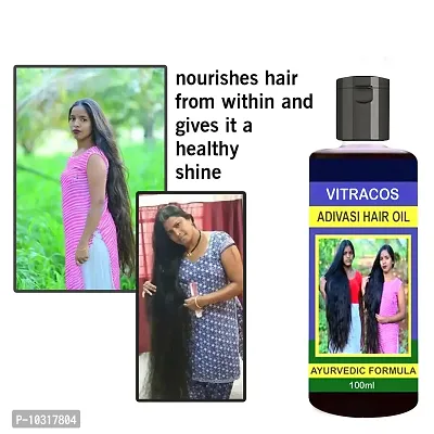 Medicine Hair Oil 1 Month Pack For Women And Men For Hair Long - Dandruff Control - Hair Loss Control - Long Hair - Hair Regrowth Hair Oil- 100 Ml 100 % Satisfaction, Best Quality, Original Brand Assured-thumb0