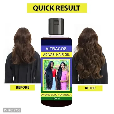 Neelambari Herbal Hair Oil For Hair Growth And Hair Fall And Dandruff Controll - 100 Ml-thumb0