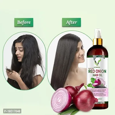 Onion Black Seed Hair Oil And Red Onion Black Seed Oil 200Ml-thumb0