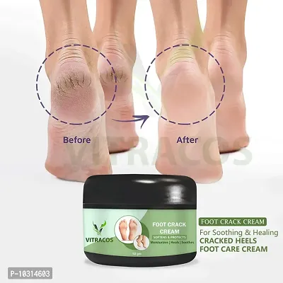 Foot Crack Cream For Dry Cracked Heels And Softening Cream 50 Grams-thumb0