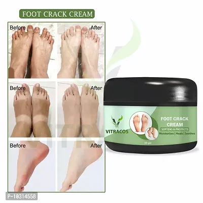 Foot Care Cream For Rough, Dry And Cracked Heel Healing And Softening Cream 50 Grams-thumb0